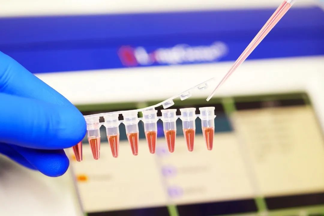 PCR/qPCR sarf materiallarini qanday tanlash mumkin?